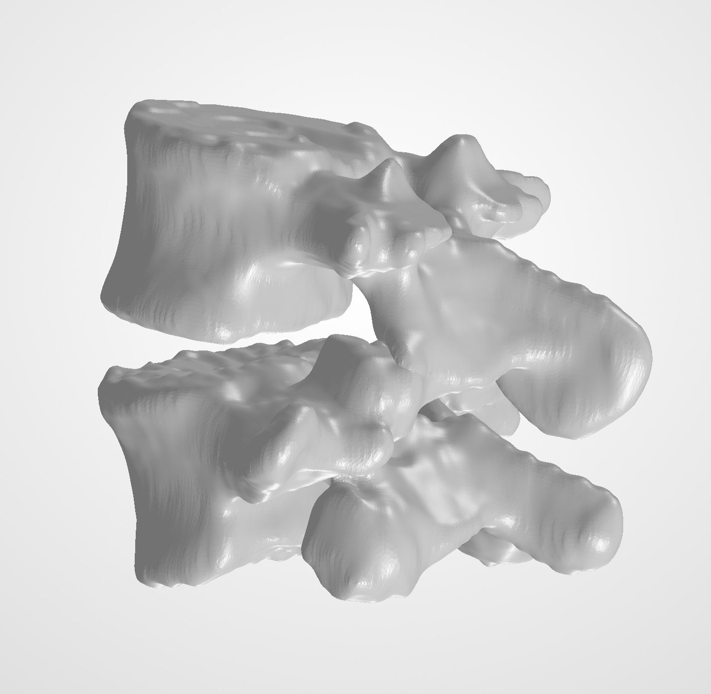 Shaded view of the L4–L5 assembly, view 1