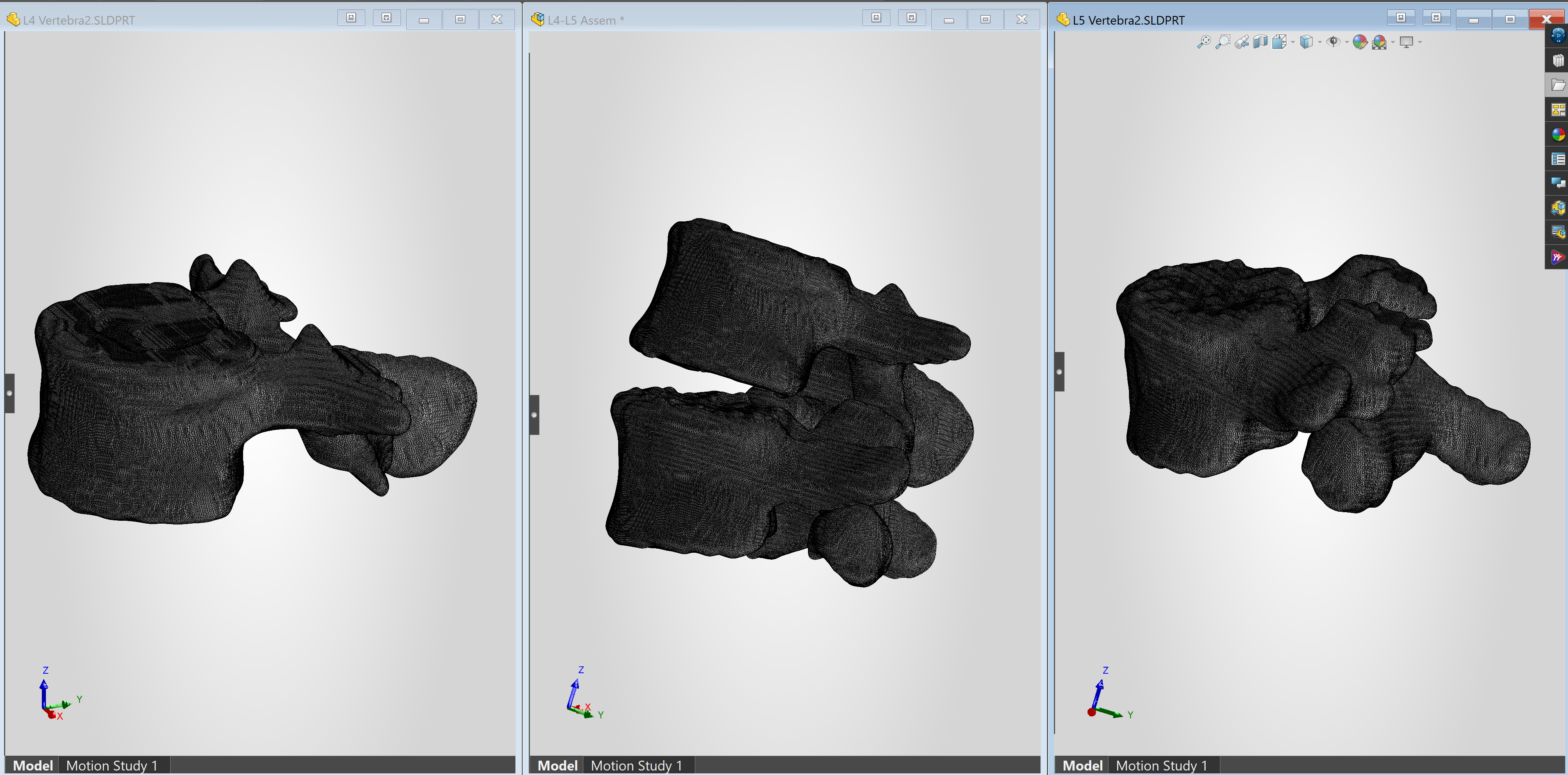 L4 and L5 STL models assembled in SolidWorks